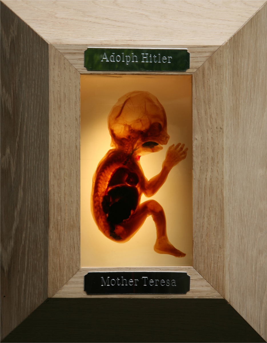 Wooden Box Frame Containing a Sculptural Fetus Depicting a Baby and Questioning It's Future Life Choices and How They Could go Either Way